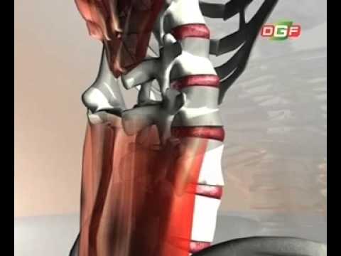 MWE-Video – Kapitel 1